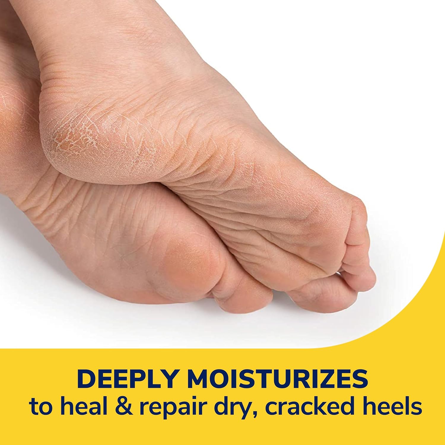 Dr. Scholl's Severe Cracked Heel Repair Restoring Balm 2.5oz, with 25% Urea for Dry, Cracked Feet, Heals and Moisturizes for Healthy Feet : Beauty & Personal Care