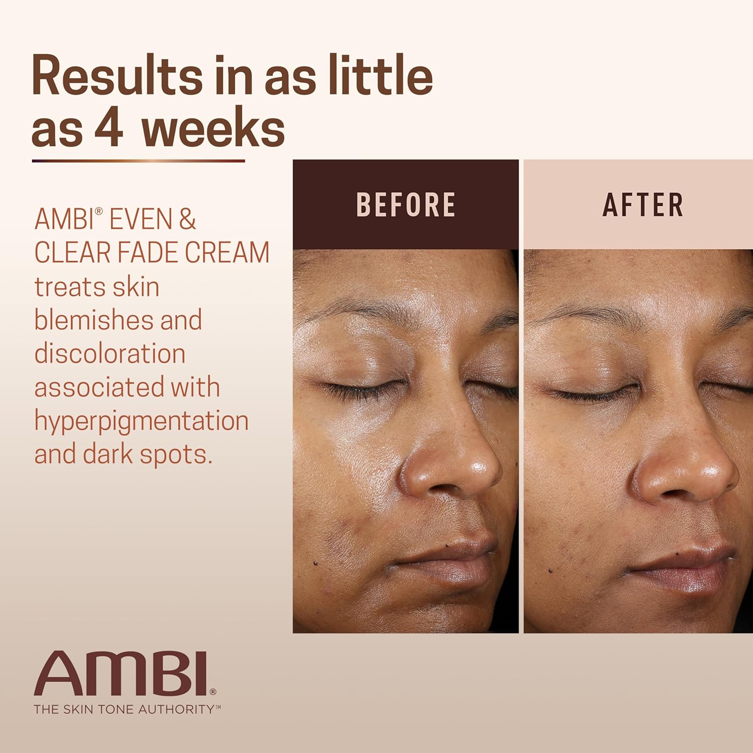 Ambi Even & Clear Fade Cream, Hydroquinone-Free, Hyperpigmentation Treatment, Dark Spot Corrector, Results In As Little As 4 Weeks, Niacinamide, Aloe Vera, Vitamin C, 1 Fl Oz : Beauty & Personal Care