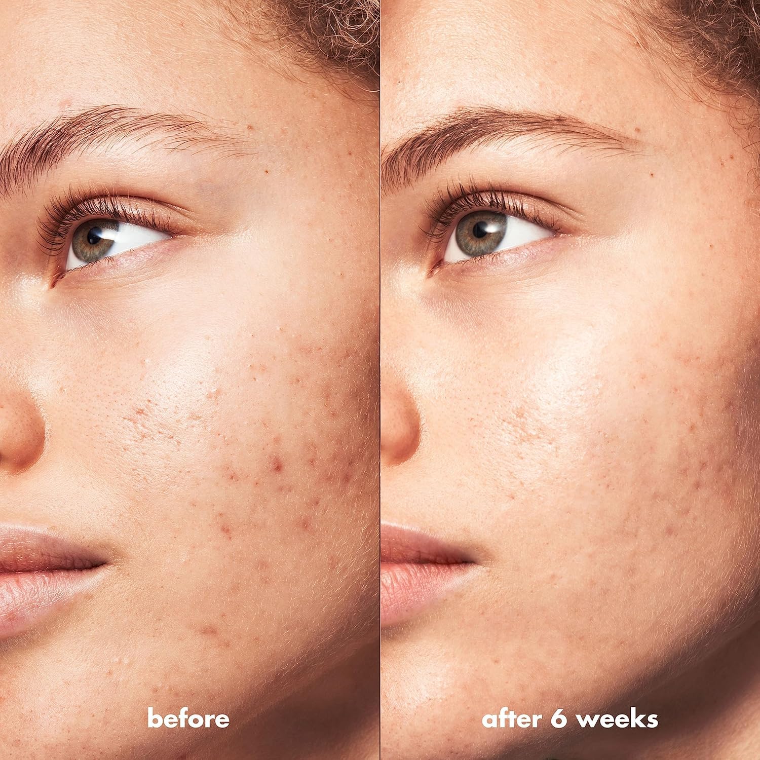 E.L.F. Skin Blemish Breakthrough Clarifying Cleanser, Gel Cleanser For Removing Makeup, Controlling Oil & Clarifying Pores, 1% Salicylic Acid : Beauty & Personal Care