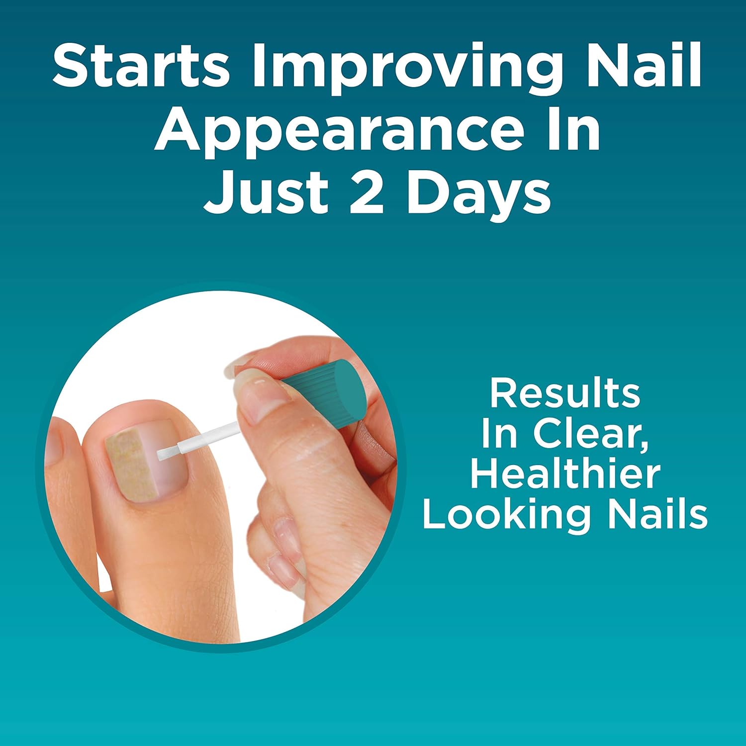 Opti-Nail 2-in-1 Fungal Nail Repair Plus Antifungal, Improves Nail Appearance and Kills Fungus Around Nail : Health & Household