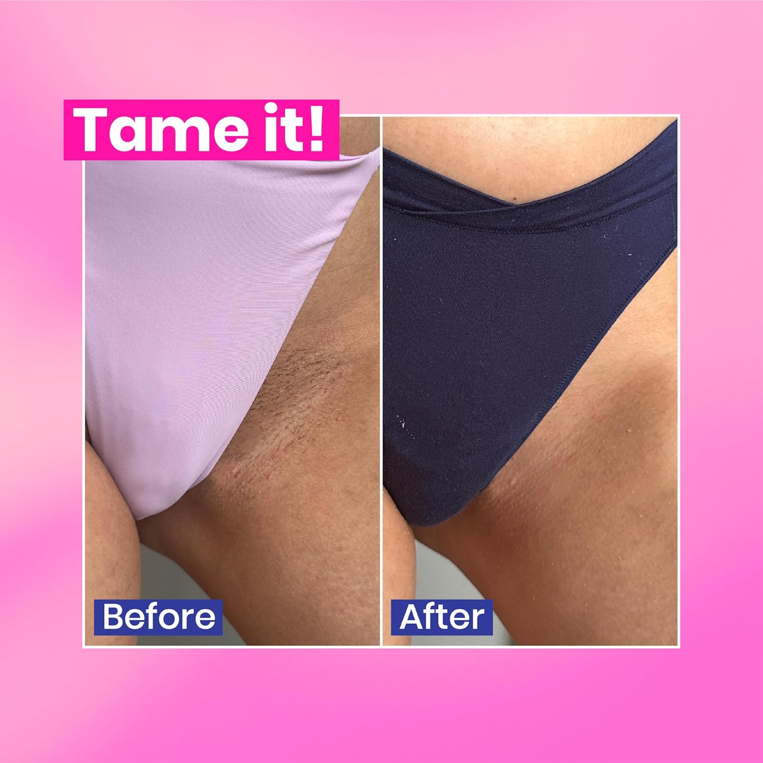 WooWoo Tame It! Natural Intimate Hair Removal Cream - Painless Vegan Hair Remover for Sensitive Skin - Depilatory for Genitals, Bikini, Legs & Bum - Women in-Shower Cream with Aloe Vera - 100ml : Amazon.co.uk: Health & Personal Care