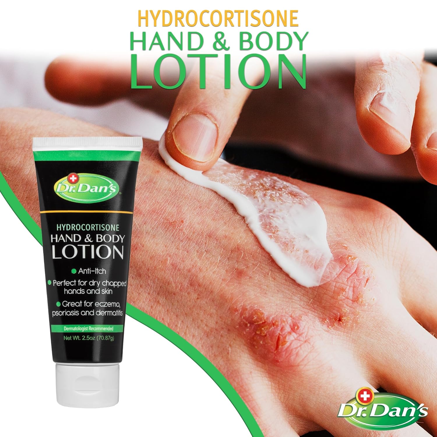 Dr. Dan's Hydrocortisone Hand and Body Lotion - Anti Itch Lotion for Men and Women - 1 Pack : Health & Household