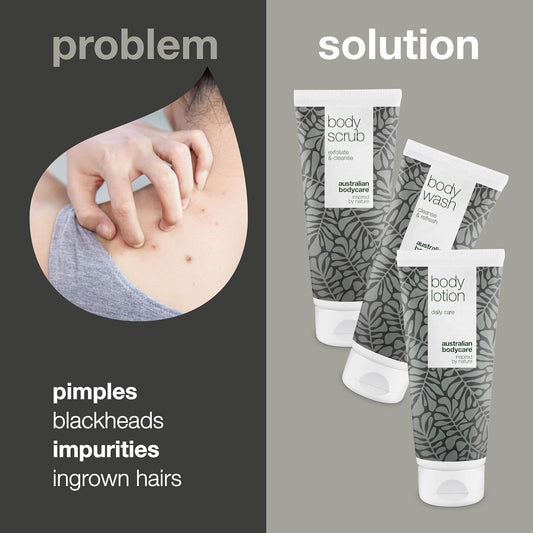 3 Products For Spots, Acne And Blackheads On The Back And Bottom From Australian Bodycare |Tea Tree Oil Specially Suited To Prevent Skin Problems On Your Back And Bottom