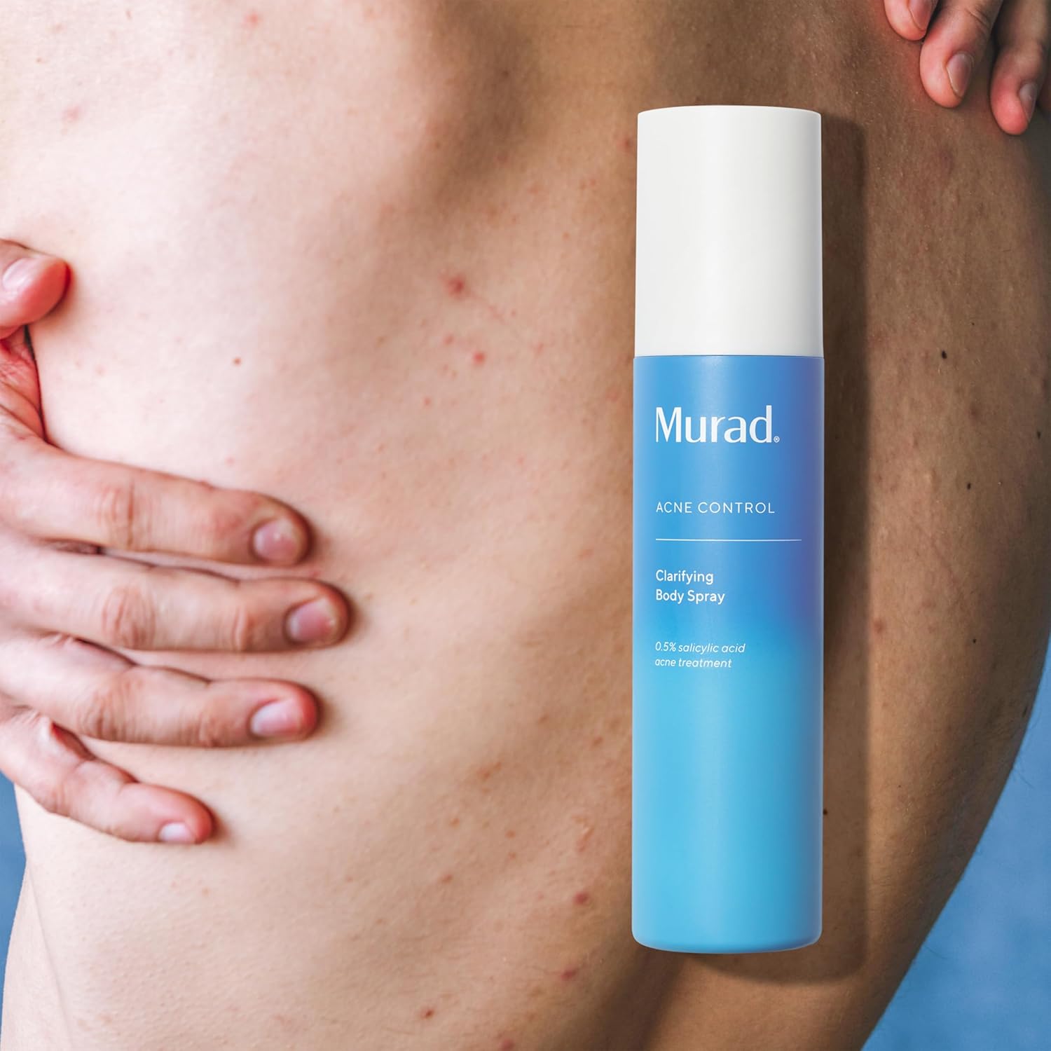 Murad Clarifying Body Spray - Daily Salicylic Acid Treatment to Clear and Prevent Body Acne and Breakouts, 6Fl Oz : Beauty & Personal Care