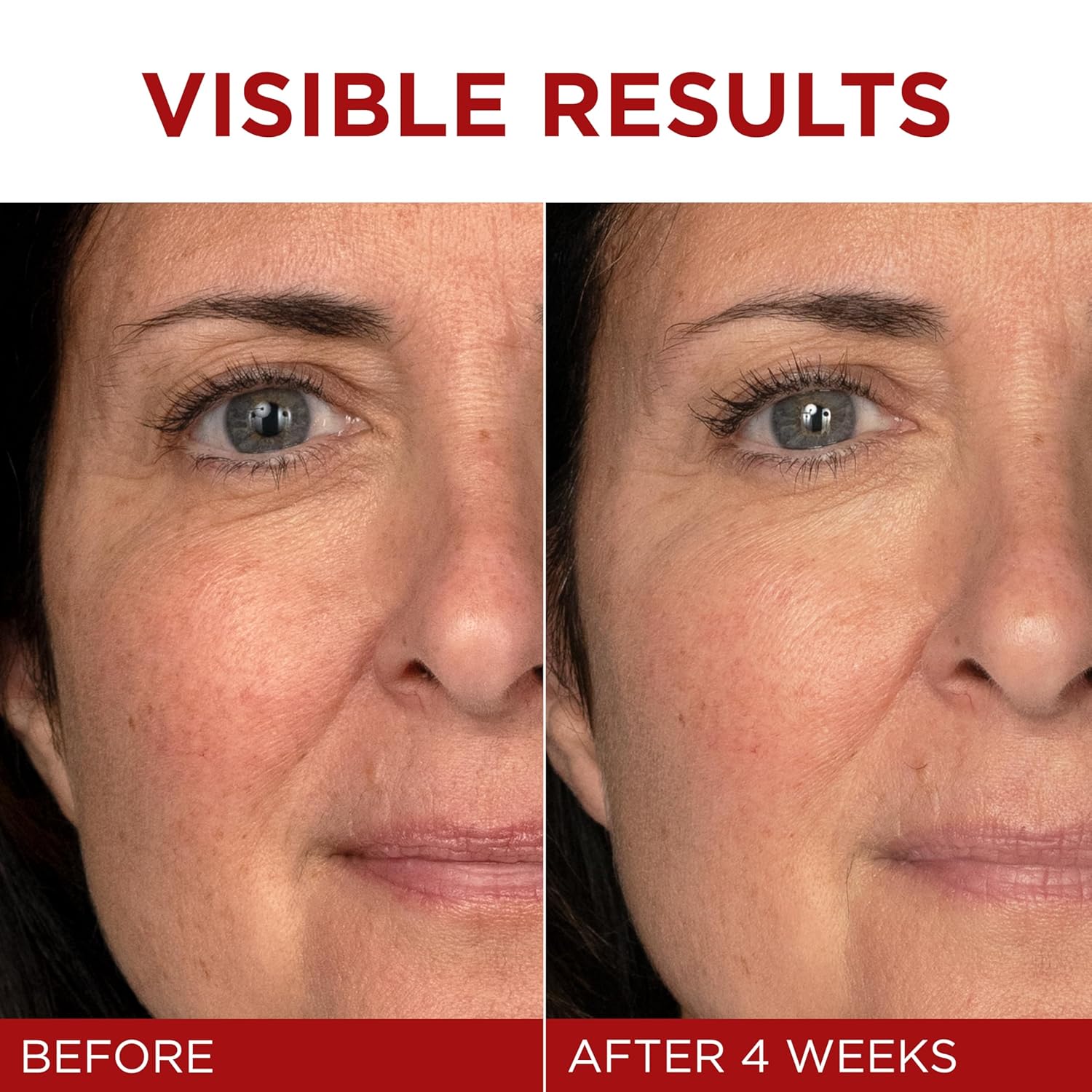 L'Oreal Paris Revitalift Triple Power Face And Neck Moisturizer, Anti Aging Face Cream With Broad Spectrum Spf 30, Pro-Retinol, Hyaluronic Acid And Vitamin C, 1 Kit : Beauty & Personal Care