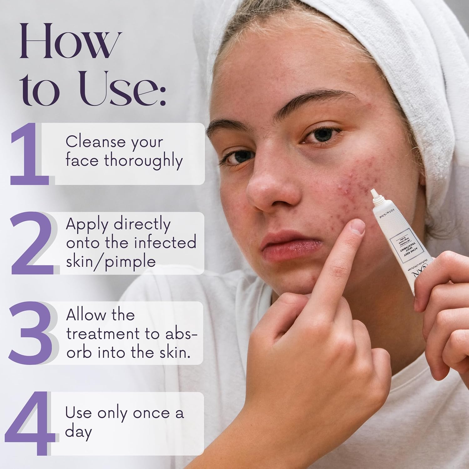 Nxn Acne Edit Spot Treatment With Probiotics, Licorice Root, Ginger And Colloidal Sulfur, To Rapidly Reduce Acne Blemish Size : Beauty & Personal Care