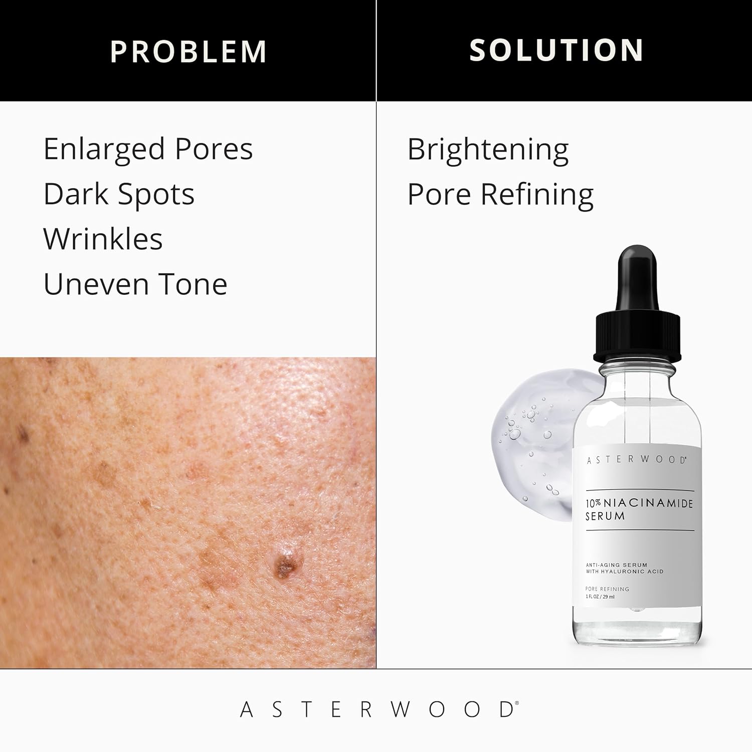Asterwood Argireline Peptide Serum 1 Oz + 10% Niacinamide Serum 1 Oz : Beauty & Personal Care