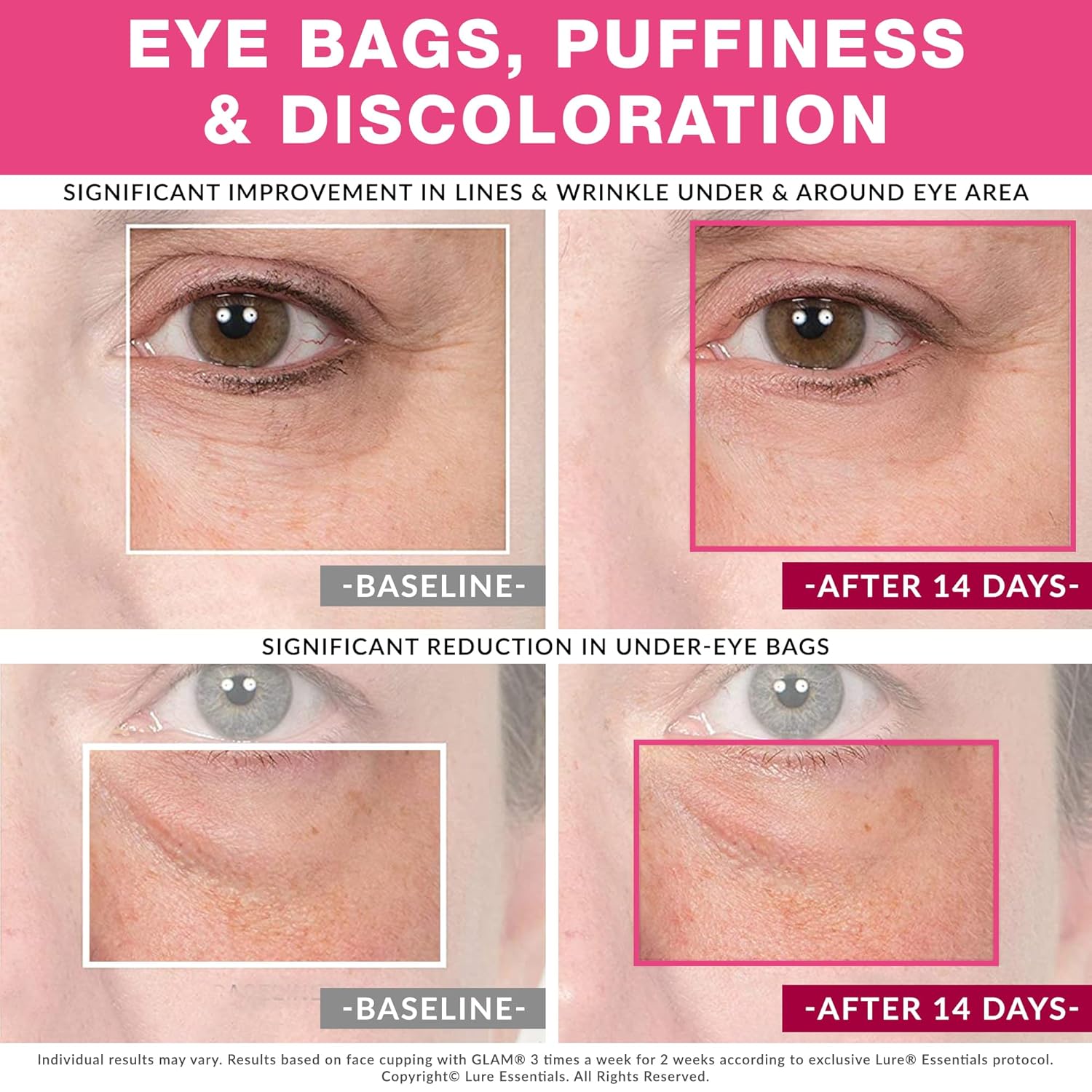 Glam Facial Face Cupping Set - Cupping Therapy Sets Massage Kit With Silicone Cleansing Brush For Instantly Ageless Skin, Works For Fine Lines & Wrinkles, Improves Collagen (Glam - Pink) : Beauty & Personal Care