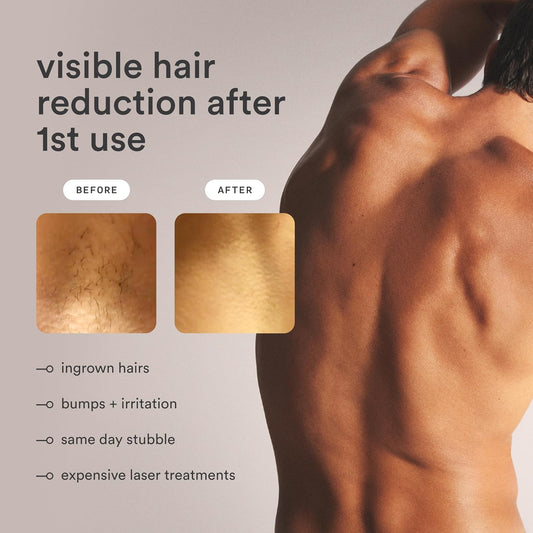 New Nood™ Flasher Pro Kit — Ipl Laser Hair Removal Device For Women & Men + Refillable 5-Blade Shaving Razor Kit + Exfoliating Buff Bar + Hydrating Shave Lube + After Shave Serum — Device T16A