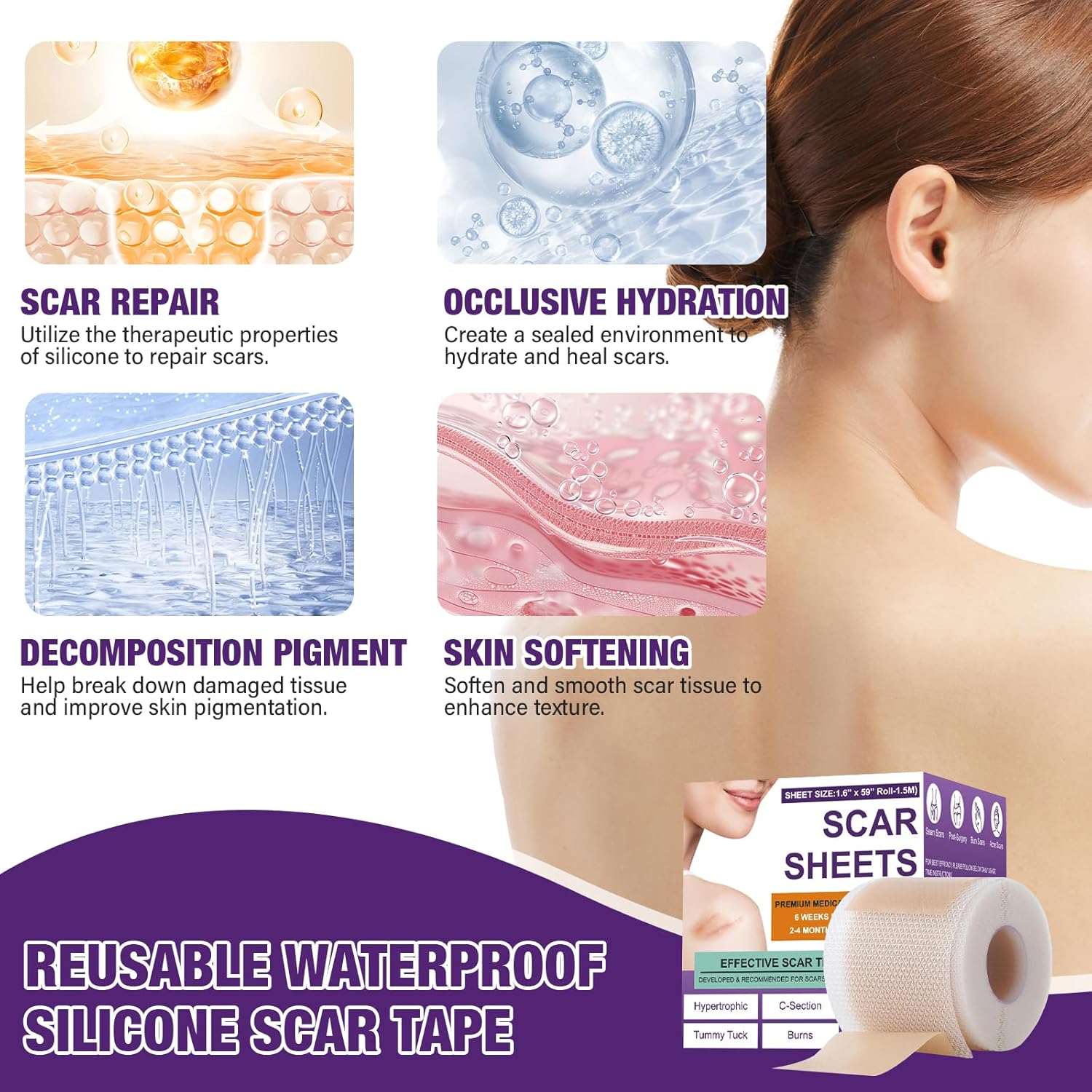 Silicone Scar Sheets,Silicone Scar Tape,Scar Tape For Surgical,C-Section,Tummy Tuck,Keloid(1.6"X 120" Roll-3M) Keloid Bump Removal : Health & Household