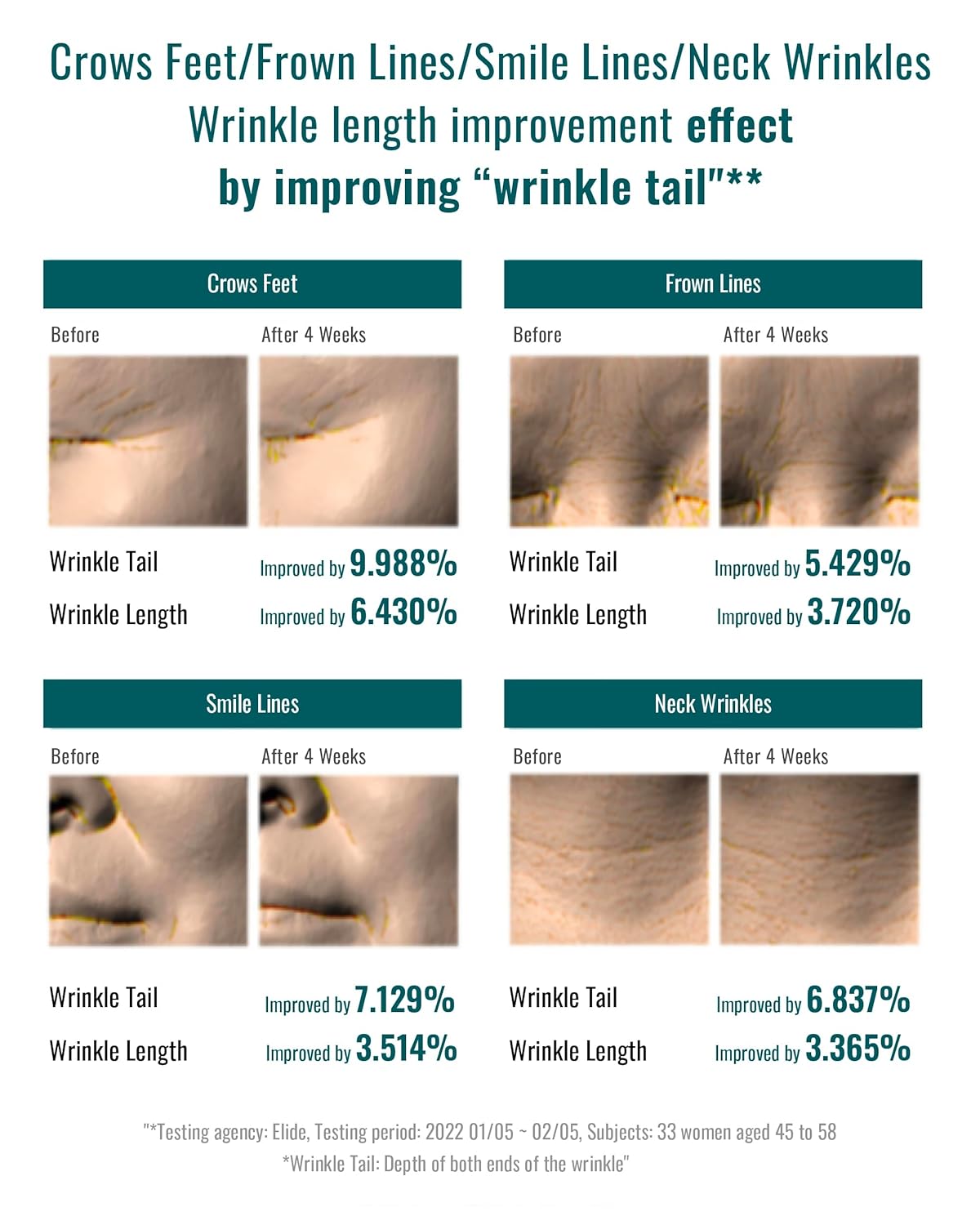 Isa Knox Age Focus Prime Wrinkle For All (4.9Fl Oz) - Plant-Based Korean Skin Care Solution For Skin Elasticity & Moisturization By Lg Beauty. Daytime Retinol. : Beauty & Personal Care