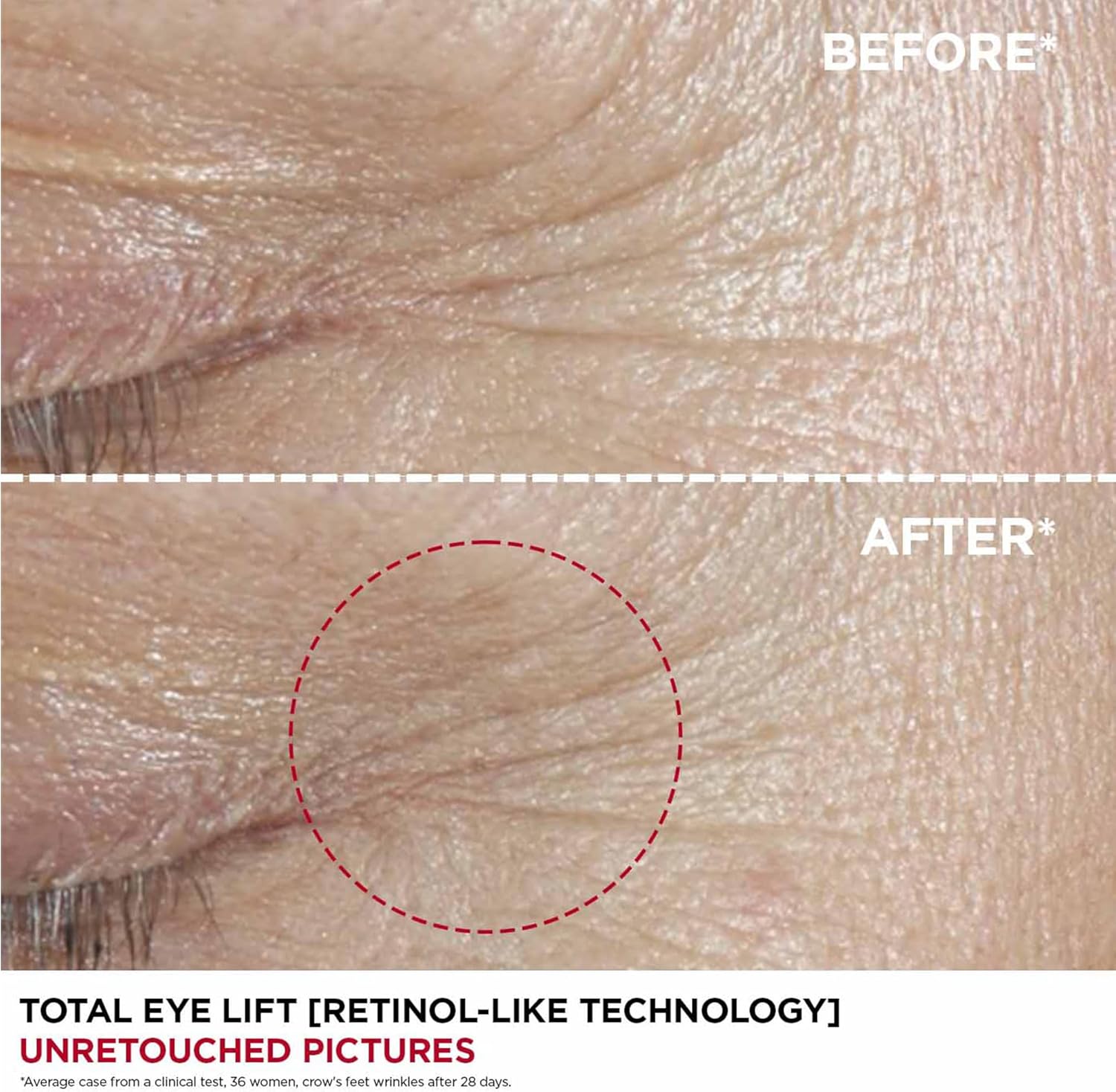 Clarins Total Eye Lift 15ml : Amazon.co.uk: Beauty