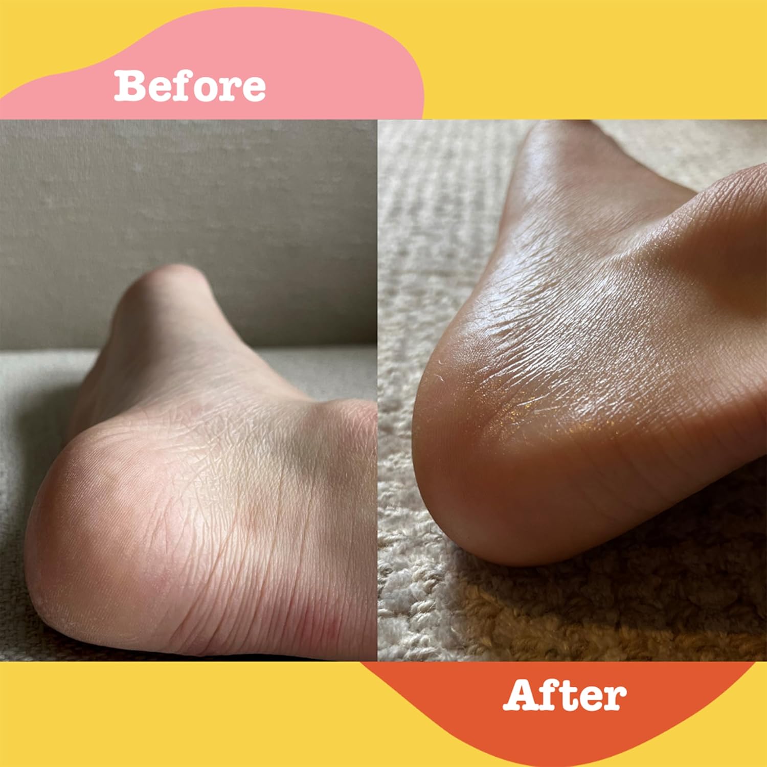 Apto Soothing Ointment W/Turmeric & Calendula: Ultra-Moisturizing Barrier Cream For Dry, Chapped Skin On Your Body, Face, Or Lips, 3 Oz. : Beauty & Personal Care