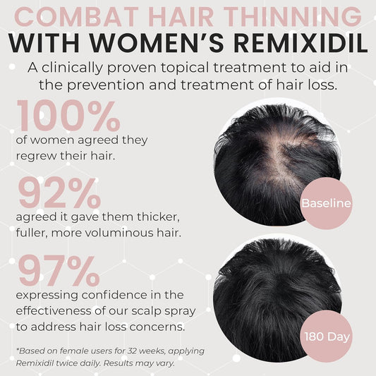 Remixidil Minoxidil 2% Hair Growth Spray For Women - Thickening, Regrowth & Loss Treatment