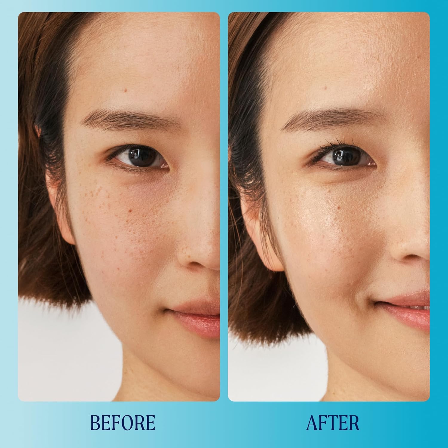 Kinship Supermello Hyaluronic Gel Cream Moisturizer – Hyaluronic Acid Face Lotion – Lightweight + Hydrating – Plump, Smooth + Soothe – Nourish Dry Skin – Rich Daily Use Clean Skin Care (3.3 Oz) : Beauty & Personal Care