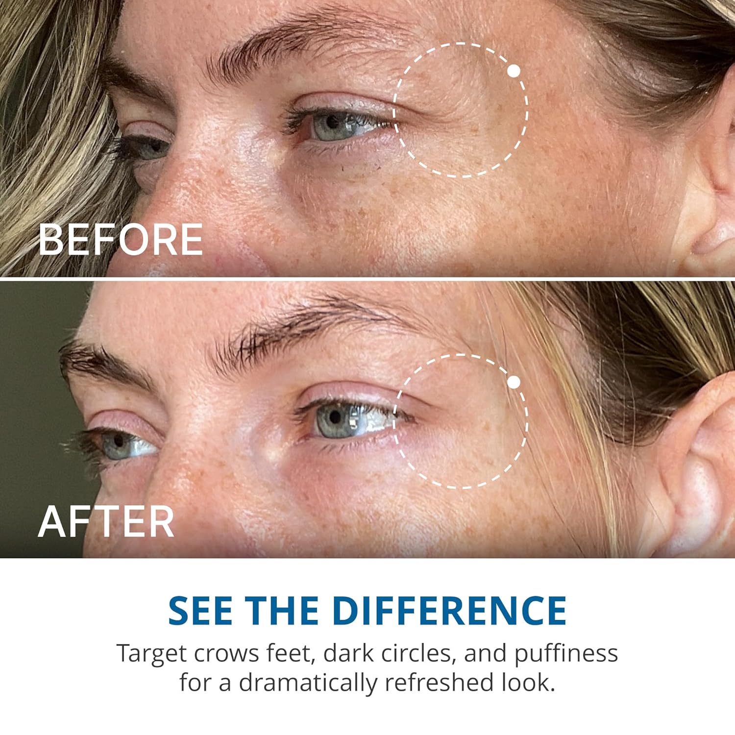 Gopure Advanced Repair Eye Cream - Under Eye Cream For Puffiness, Bags, And Dark Circles, Visibly Improve The Look Of Fine Lines, Wrinkles, And Crows Feet - 0.57 Fl Oz