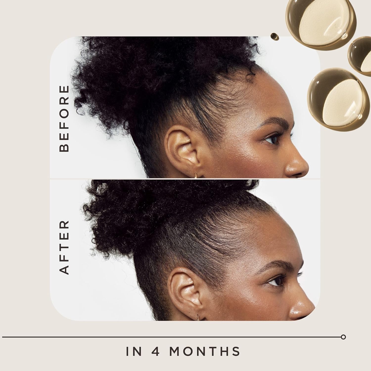 Carol'S Daughter Goddess Strength Hair Regrowth Treatment For Women, 2% Minoxidil Solution For Hair Loss And Thinning, One Month Supply, 2 Fl Oz : Beauty & Personal Care