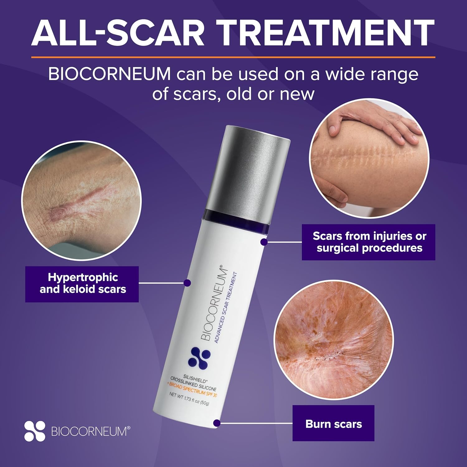 Biocorneum Advanced Scar Treatment With Silishield® & Spf 30 10G – Made In The Usa, Fast-Drying, Silicone Scar Gel - Surgeon Recommended For New & Old Scars - Suitable For Children Over 6 Months : Scar Reducing Treatments : Health & Household