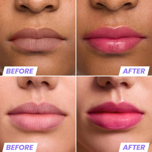 Wonderskin Lip Oil Rehab Serum - Hydrating And Moisturizing Clear Serum For Dry Lips - Natural, Vegan And Non-Sticky (Clear)