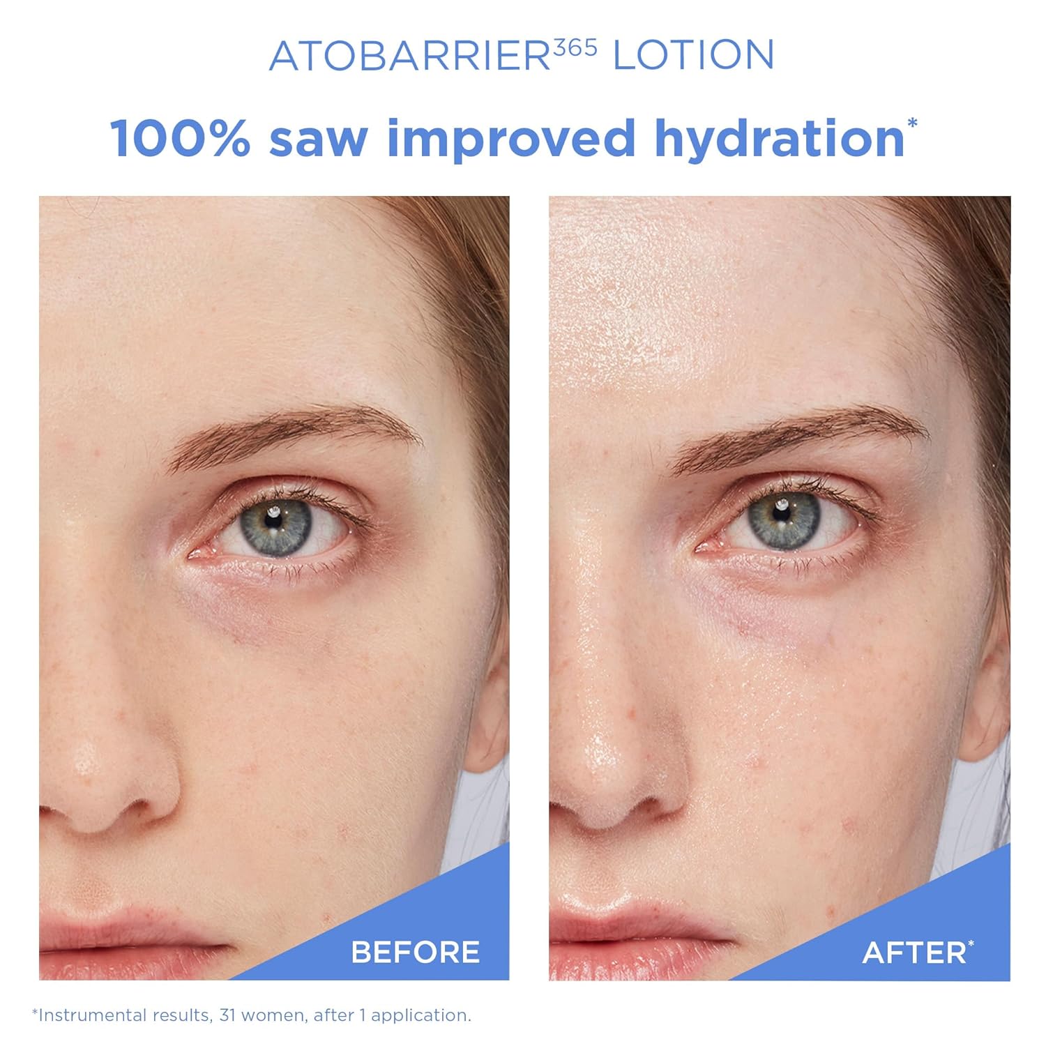 Aestura Atobarrier365 Lightweight Lotion + Cleanser : Beauty & Personal Care