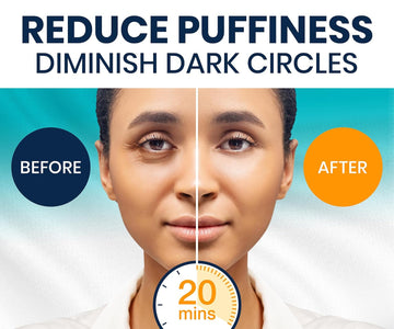 Stylia Under Eye Patches For Puffy Eyes And Dark Circles (12 Pairs) - Marine Collagen Under Eye Mask With Vitamin C, Hyaluronic Acid, Pearl Extract - Eye Masks For Dark Circles And Puffiness