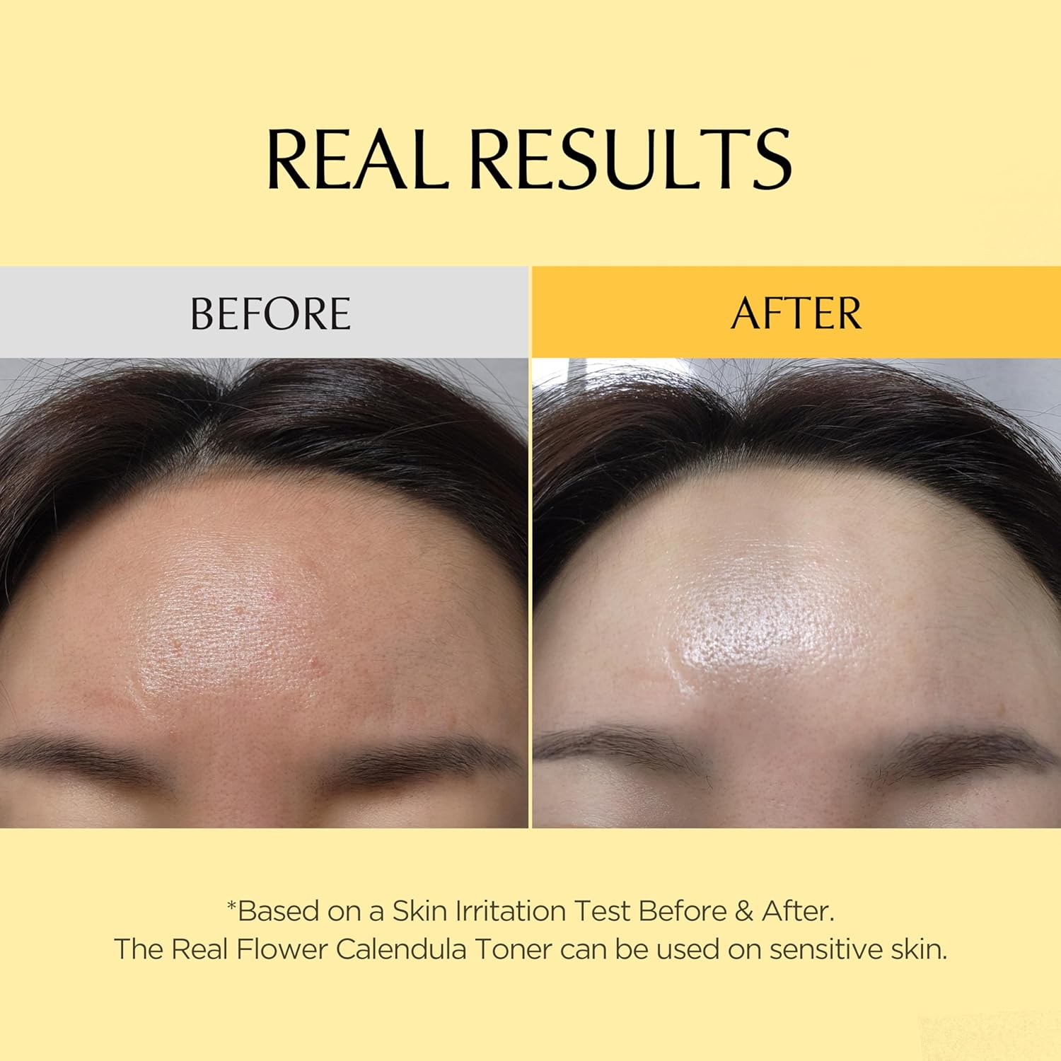 Neogen Dermalogy Real Flower Toner Calendula (300Ml)