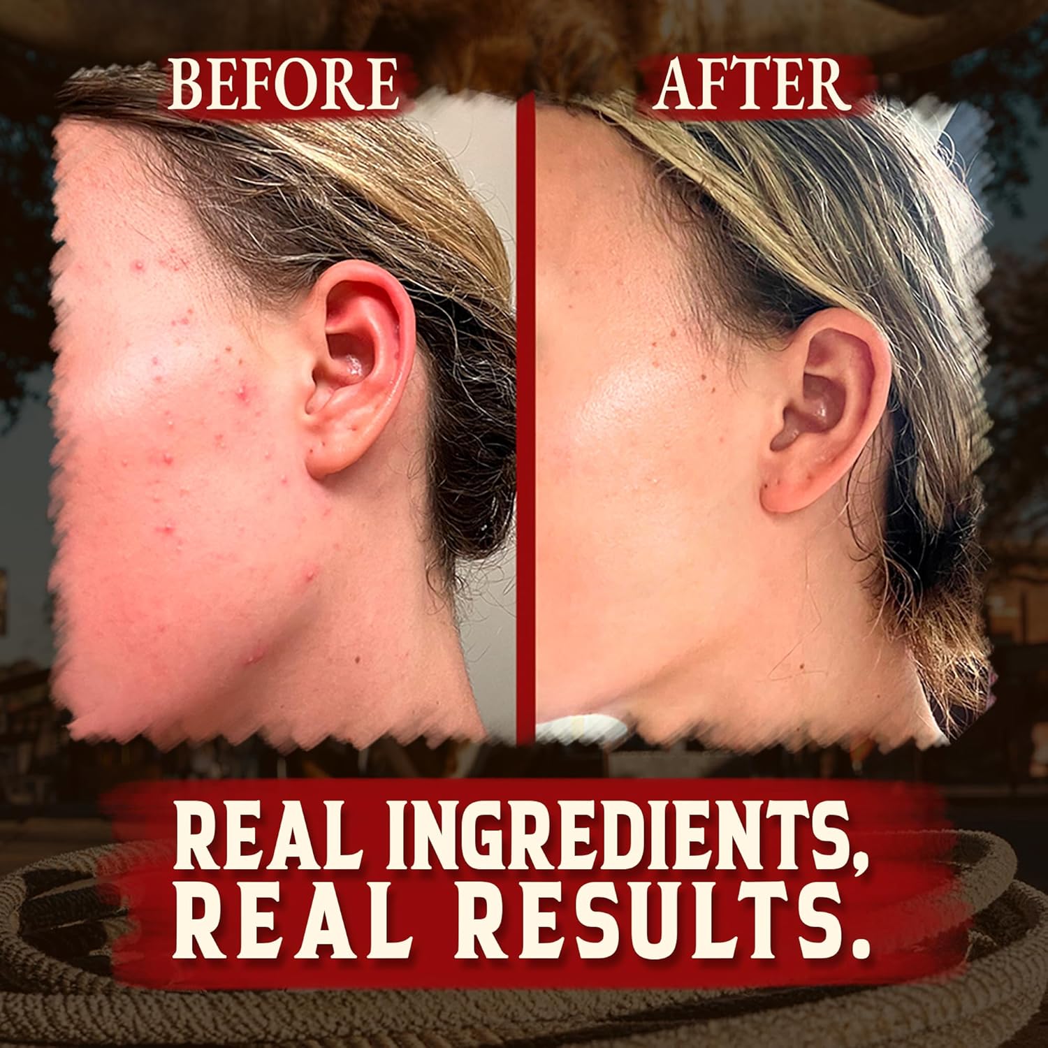 Wrath & Remedy Handmade Whipped Organic Beef Tallow For Skin - 4 Oz (Unscented) — Grass Fed Beef Tallow Moisturizer And Honey Balm For Silky, Sensitive-Skin, Eczema, Rosacea - Free Of Harsh Chemicals : Beauty & Personal Care