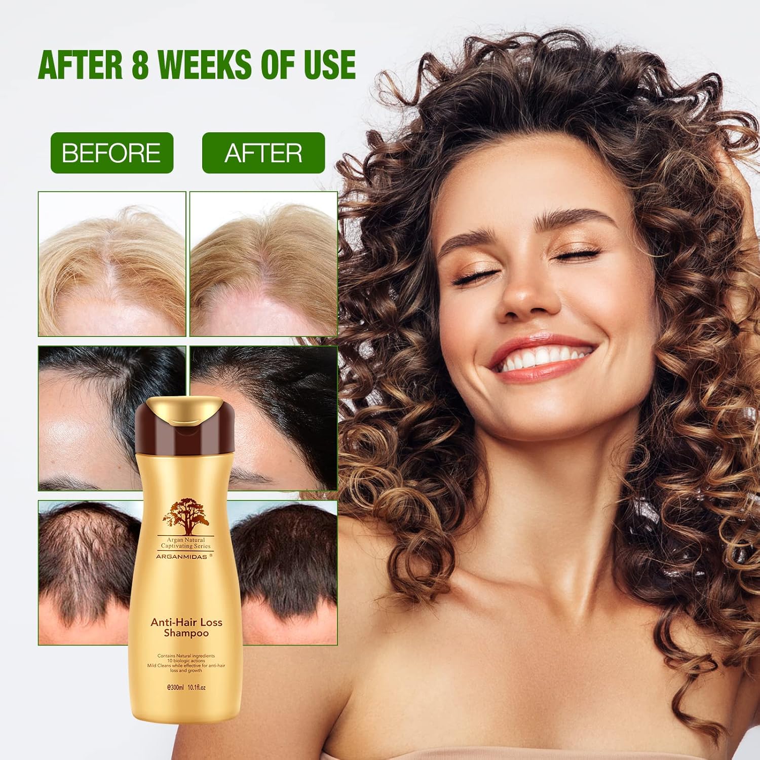 Anti-Hair Loss Shampoo For Hair Growth And Thickening, Combats Hair Loss Caused By Perm And Pressure, Suitable For Men And Women, Delightful Fragrance