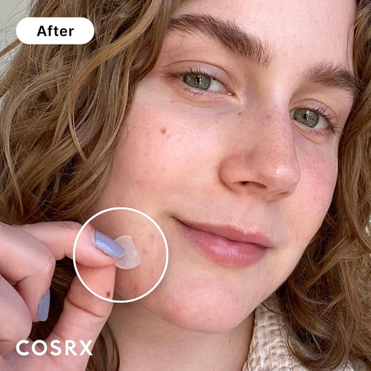 Cosrx Acne Pimple Patch Absorbing Hydrocolloid Original 3 Size Patches For Blemishes And Zits Cover, Spot Stickers For Face And Body, Not Tested On Animals
