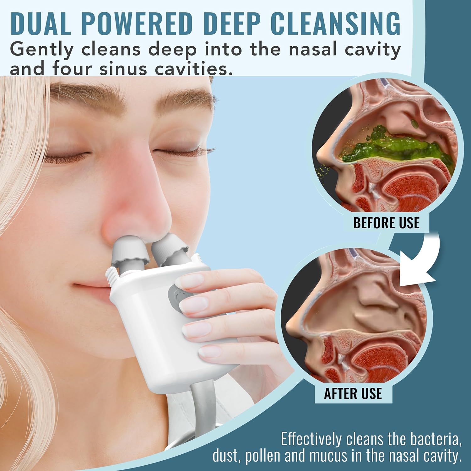 Nasalfresh Md Premium Bundle–Dual Powered Nasal Irrigation System Nasal Rinse And Wash, Sinus Decongestant Relief System, 60 Saline Packets, Case, Rechargeable, 2 Sets Of Nose Pillows–Snoring Remedy : Health & Household