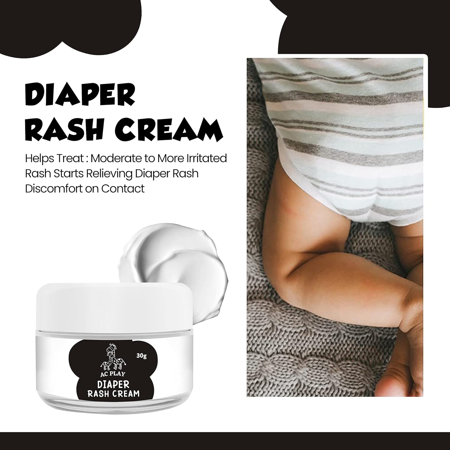 Extreme Relief Diaper Rash Cream - Maximum Strength - Non Toxic - Sensitive Safe - Soothing & Hydrating - Healing Ointment - ACPLAY : Baby