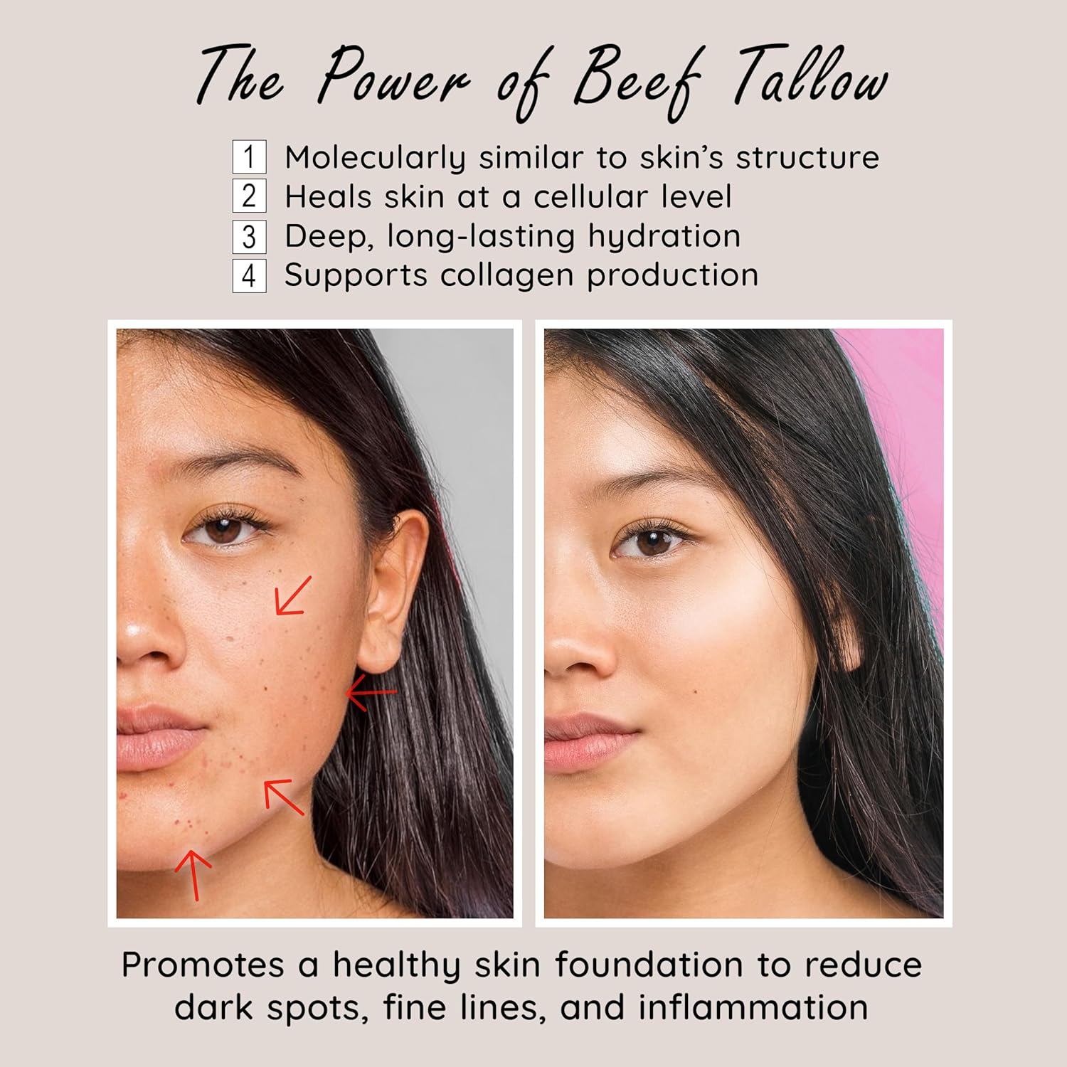 Jeune Jolie Handmade Whipped Milky Beef Tallow For Skin With Jojoba & Rose Oil - Made In Usa - 100% Grass Fed & Organic Oils - Non-Greasy Silky Soft Moisturizer, For Normal To Dry Skin : Beauty & Personal Care