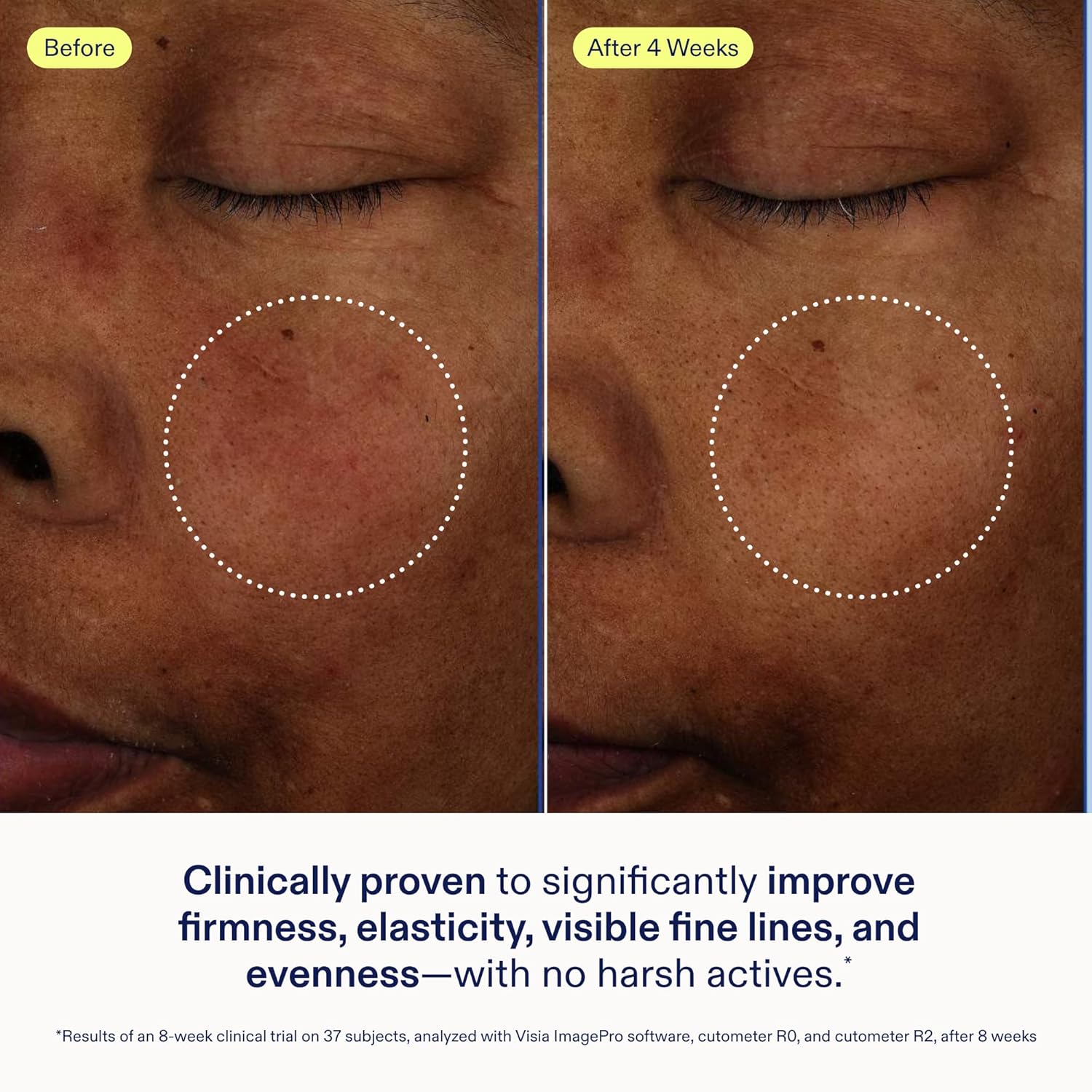 Skinfix Exo + Ectoin Intensive Repair Baume - 1 Oz - Retinol-Free Face Serum - Visibly Smooths Wrinkles + Evens Dark Spots And Redness - Fragrance Free - Vegan, Cruelty Free : Beauty & Personal Care