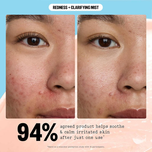 Peace Out Skincare Redness & Clarifying Mist, Hypochlorous Acid Spray Helps Reduce Redness And Excess Oil, Balancing Facial Spray For Acne-Prone Skin, 3.3 Fl Oz