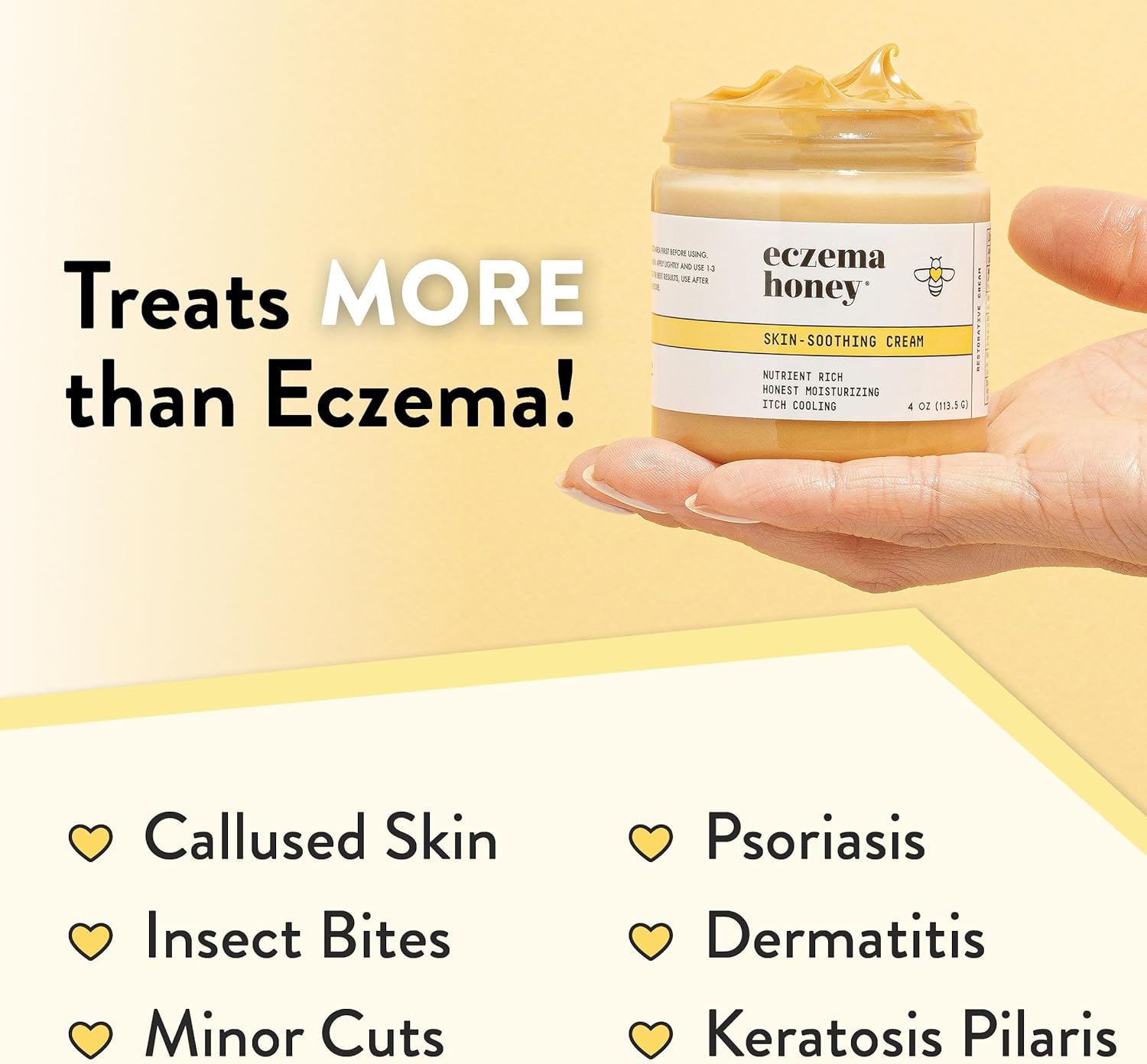 ECZEMA HONEY Original Skin-Soothing Cream - Organic Hand & Body Eczema Relief - Natural Honey Lotion for Dry, Itchy, & Irritable Skin (4 Oz) : Health & Household