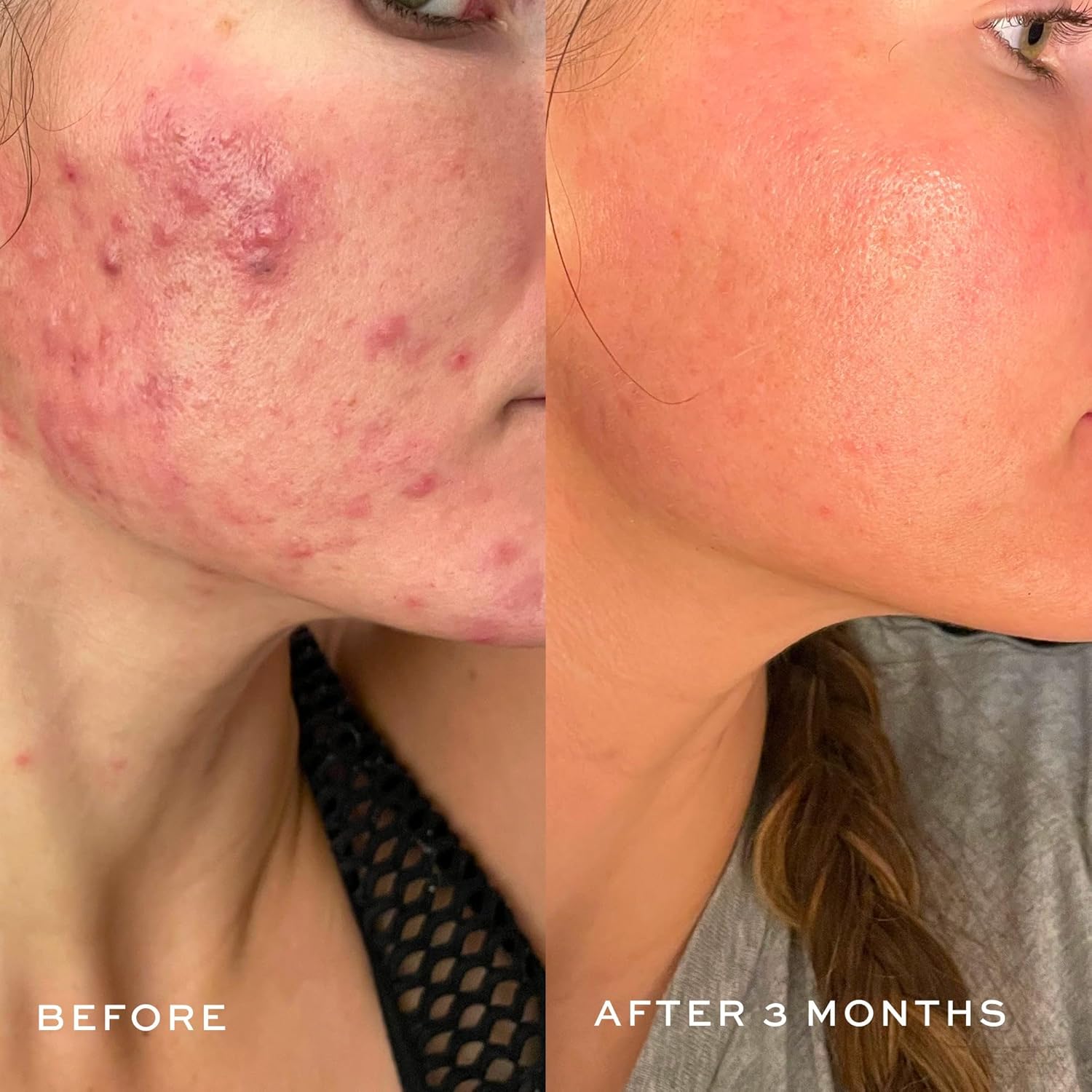 Dime Beauty Creamy Foam Cleanser, Foaming Face Wash, Daily Salicylic Acid Facial Cleanser For Oily Skin, 4 Oz / 120 M : Beauty & Personal Care