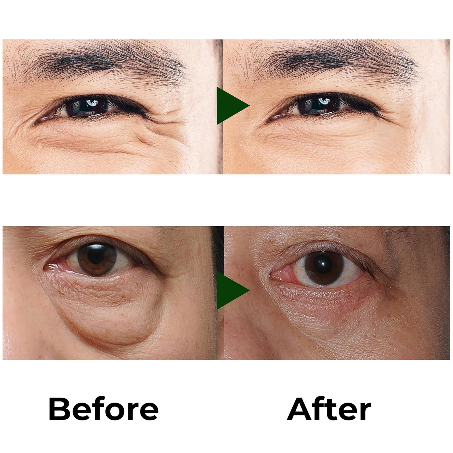 Abera Eye Roller Serum For Men – Eye Bags, Dark Circles & Puffiness Treatment – Mint Essence With Vitamin C & Peptides 0.34 Fl Oz