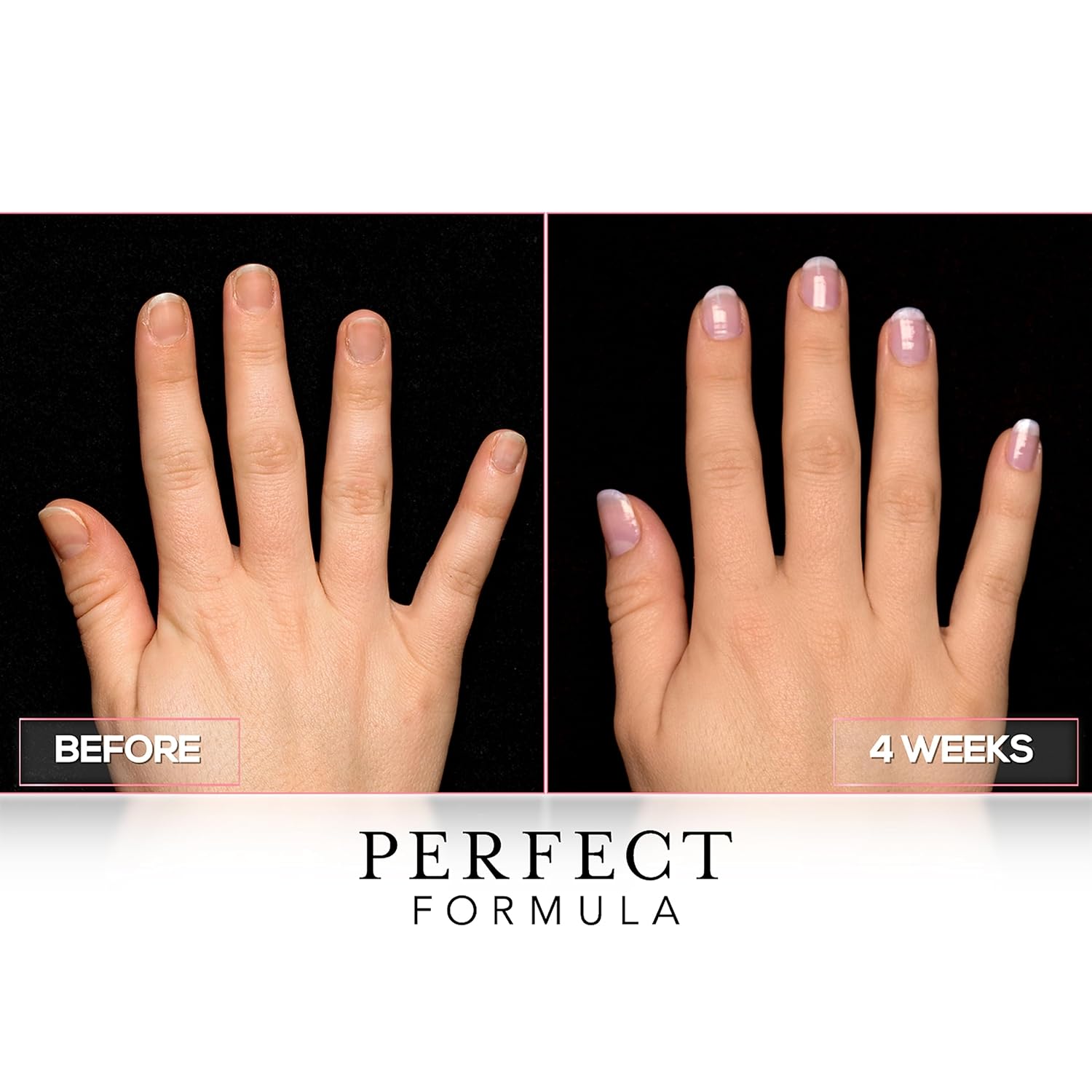 Perfect Formula Ruby Pink Gel Coat - Nail Strengthener, Keratin Nail Treatment, Gemstone Pink Gel Nail Polish - Nail Strengthener For Damaged Nails - Made In The Usa .60 Fl Oz. : Beauty & Personal Care