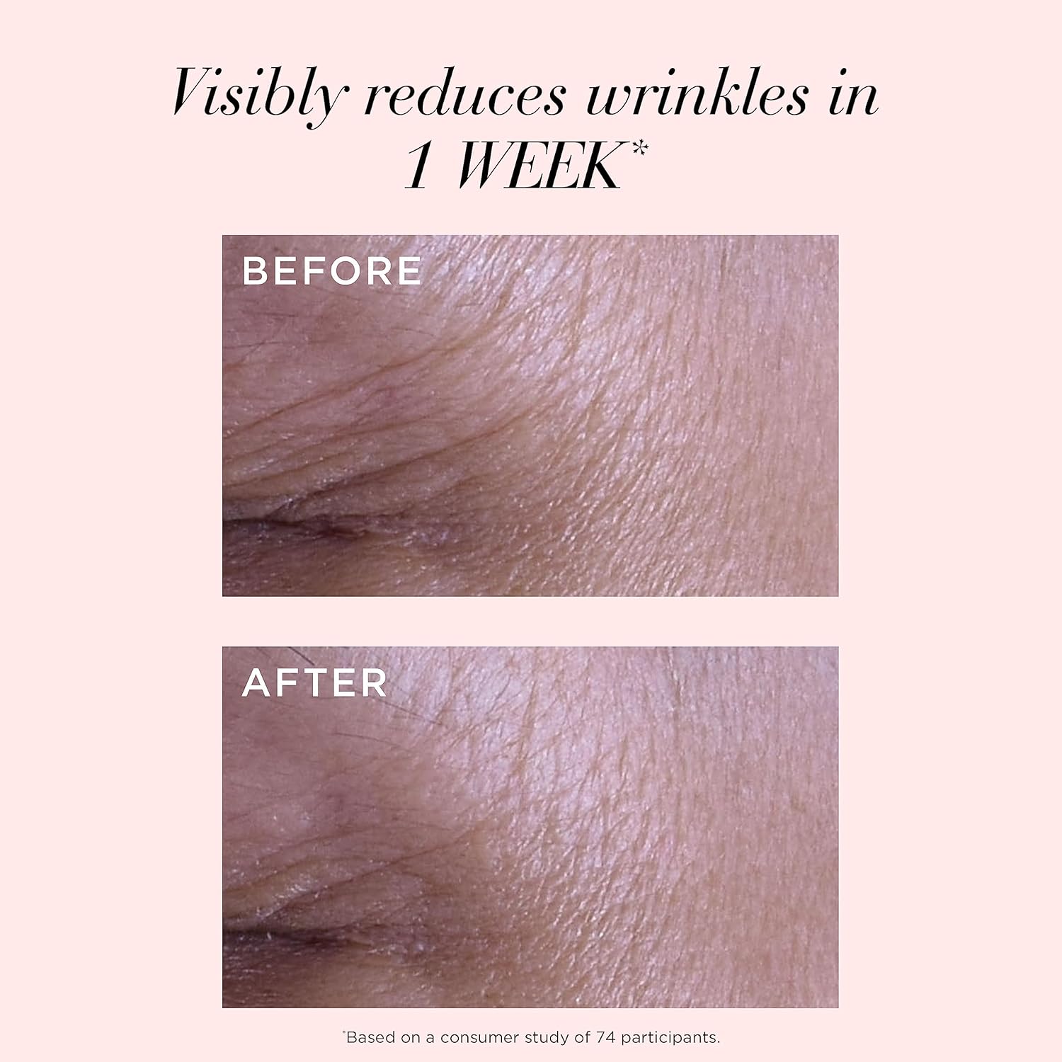 Elizabeth Arden Retinol Serum Wrinkle Filler + Hpr Next Generation Retinoid, Ceramide, And Peptide Rapid Skin Renewing Water Day And Night Cream For Face And Neck