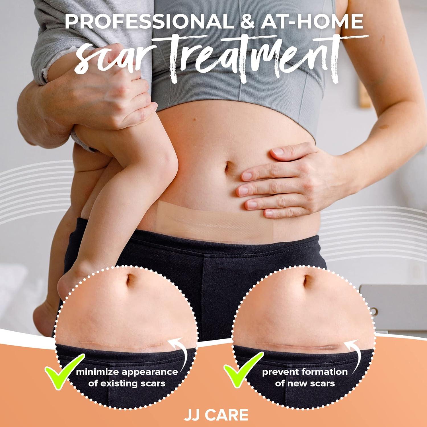 Jj Care Soft Silicone Tape, 1.6” X 120” Flexible Silicone Scar Tape, Medical Grade Silicone Strips For Scars, Washable & Reusable Scar Tape For Surgical Scars, Latex-Free Scar Tape : Health & Household