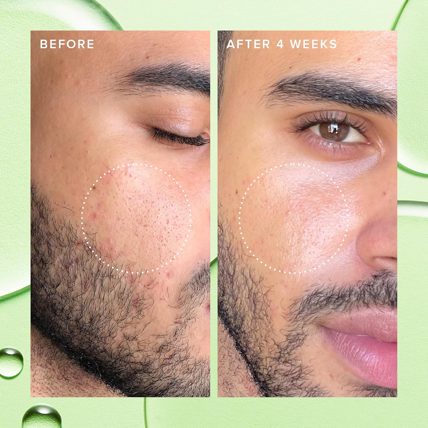 Farmacy 2% Salicylic Acid Toner For Face - Deep Sweep Gentle Bha Exfoliant For Oily Skin - Refines Texture With Papaya Enzymes & Moringa Water For A Healthy-Looking Complexion (50Ml) : Beauty & Personal Care