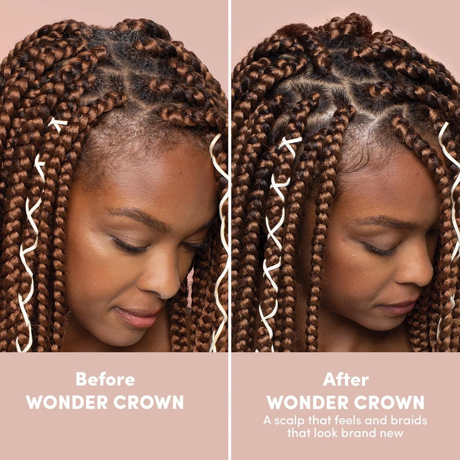 Mizani Wonder Crown Scalp Cleanser - Helps Stimulate Hair Growth, Removes Buildup And Oil With Tea Tree And Peppermint Oil, For Dry & Itchy Scalps : Beauty & Personal Care