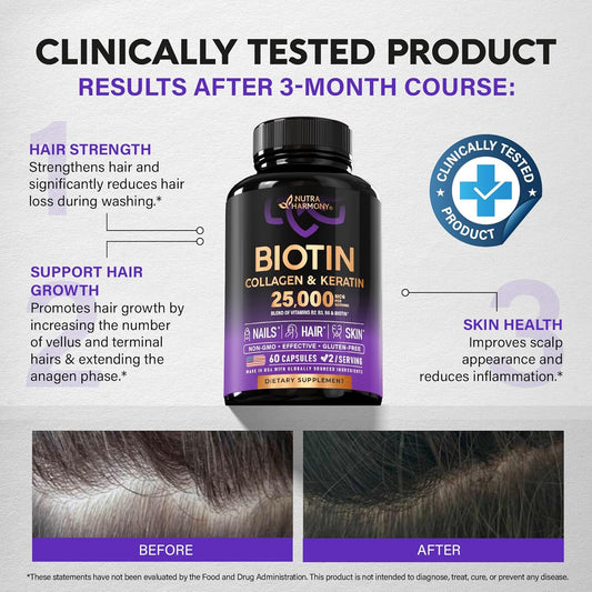 Biotin | Collagen | Keratin - Clinically Tested Supplement - Hair Growth Support - Skin & Nails Complex - 25000 Mcg Vitamins B2, B3, B6 & B7 | Hyaluronic Acid - Made In Usa - Women & Men | 60 Capsules