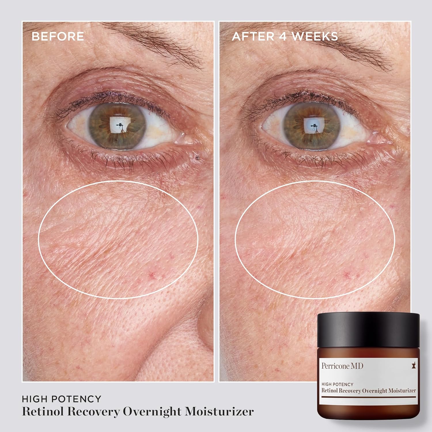 High Potency Retinol Recovery Overnight Moisturizer, 2 Fl. Oz. : Beauty & Personal Care