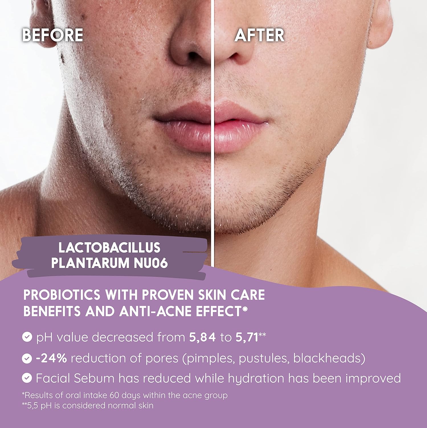 Probiotics for a Healthy Skin. Reduces Spots & Imperfections. Anti Acne effect. Improves Elasticity, Firmness & Luminosity. With SKINAX²™, Zinc & Vitamins. 45 capsules. CE. Vegan. N2 Natural Nutrition : Amazon.co.uk: Beauty
