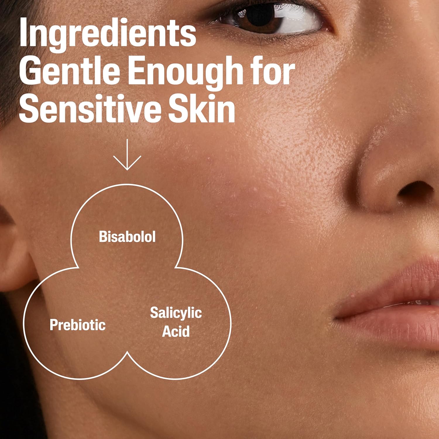 Cetaphil Face Moisturizer, Gentle Clear Mattifying Acne Moisturizer With 0.5% Salicylic Acid, Hydrates And Treats Sensitive Acne Prone Skin, Skin Care For Sensitive Skin, 3Oz : Beauty & Personal Care