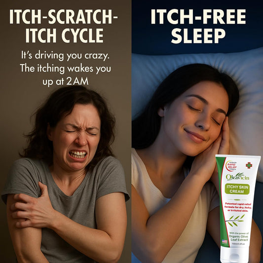 Organic Extra Strength Anti-Itch Cream For Dry, Itchy Skin Relief – Natural Fungal & Rash Treatment With Olive Leaf Extract – Fast-Acting, Long-Lasting Itch Relief