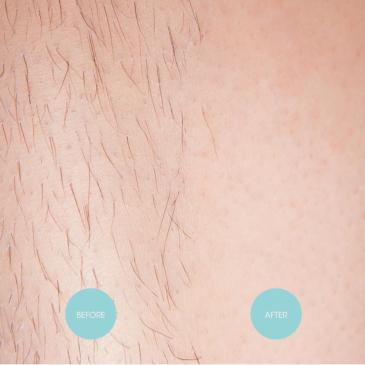 Nad's Extra Long Wax Strips, Hair Removal, Large Waxing Strips, 20 Strips : Amazon.co.uk: Health & Personal Care
