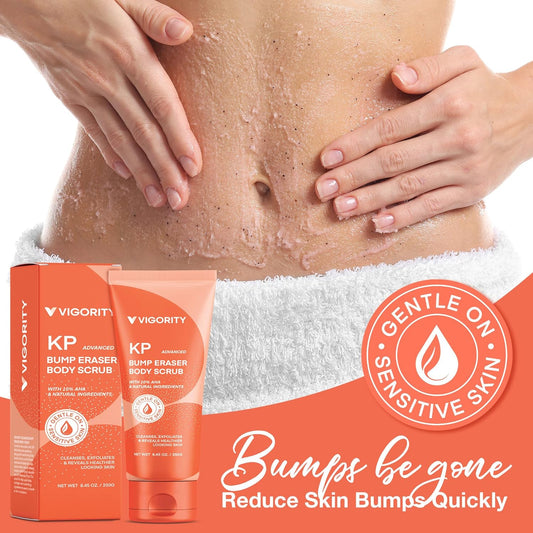 Kp Bump Eraser Body Scrub, Bump Eraser Body Scrub, Keratosis Pilaris Treatment, Strawberry Legs Treatment For Women, Kp Bump Eraser, Kp Body Scrub, Exfoliating Body Scrub For Women & Men Exfoliation