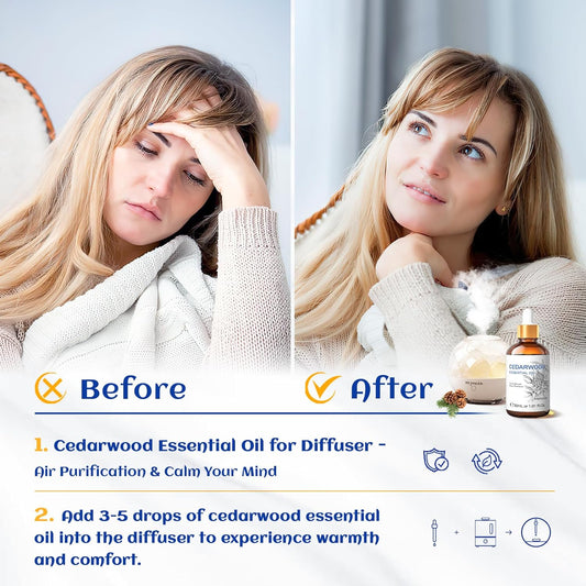 HIQILI 1 Fl Oz Cedarwood Essential Oil, Pure Natural Cedarwood Oil for Hair, Diffuser, Aromatherapy,- 30ML